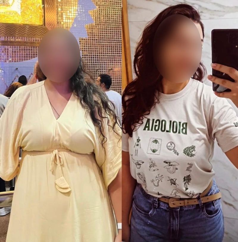 Antes e depois de paciente da Dra. Brendha