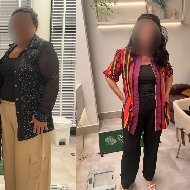 Antes e depois de paciente da Dra. Brendha