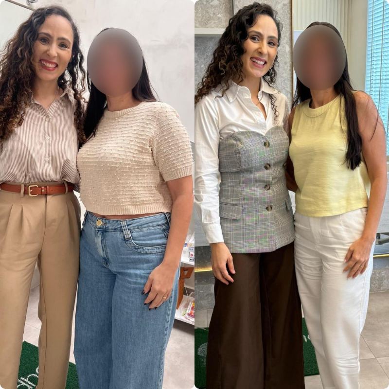 Antes e depois de paciente da Dra. Brendha