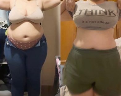 Antes e depois de paciente da Dra. Brendha