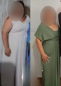 Antes e depois de paciente da Dra. Brendha