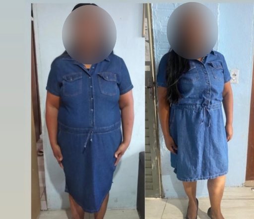 Antes e depois de paciente da Dra. Brendha