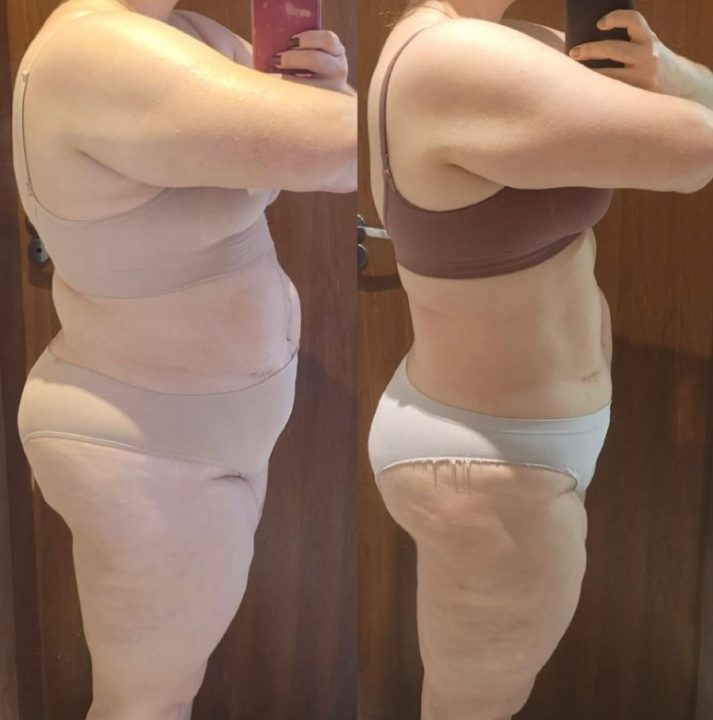 Antes e depois de paciente da Dra. Brendha