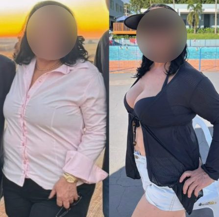Antes e depois de paciente da Dra. Brendha
